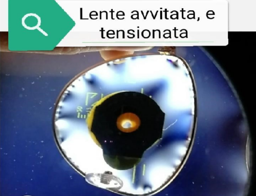 Tensionatura scorretta, un possibile problema per le lenti